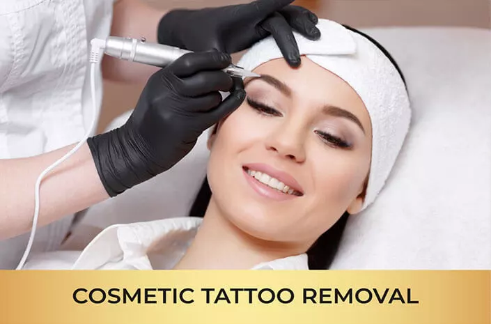 Cosmetic Non Laser Tattoo Removal